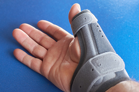 El tratamiento utiliza ortesis de refuerzo